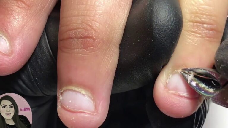 Descubre la increíble crema antinail biting para uñas perfectas