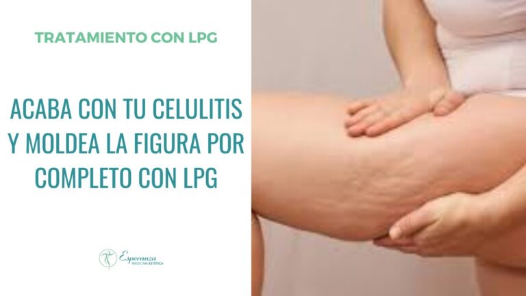 Descubre la Impactante Transformación de la Celulitis con LPG: ¡Antes y Después!